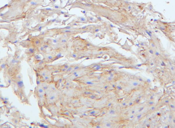 IHC - Anti-E Cadherin 1 CDH1 Antibody Picoband™ (monoclonal, 9G2) ABO14856